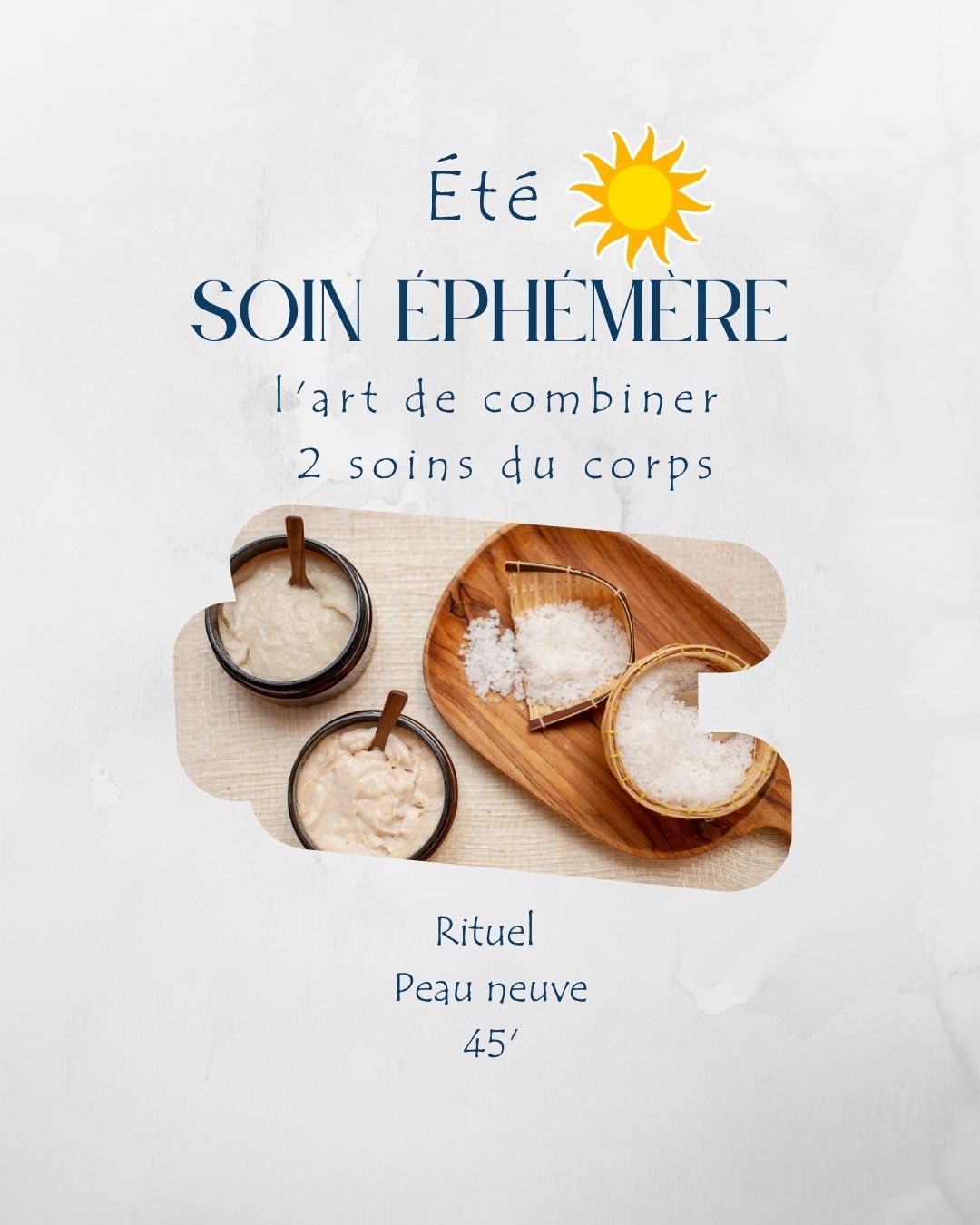 ete
